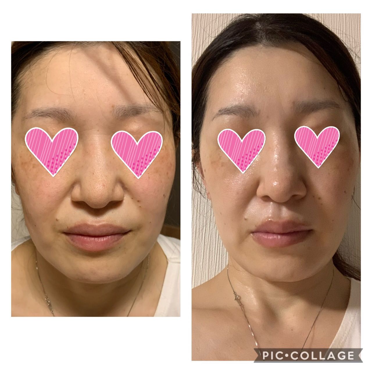 美肌の為に | 伊勢崎店 | メイキングランジェリー・補整下着 マルコの