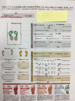 オーソティクスの体験してみませんか | 岐阜駅前店 | メイキング